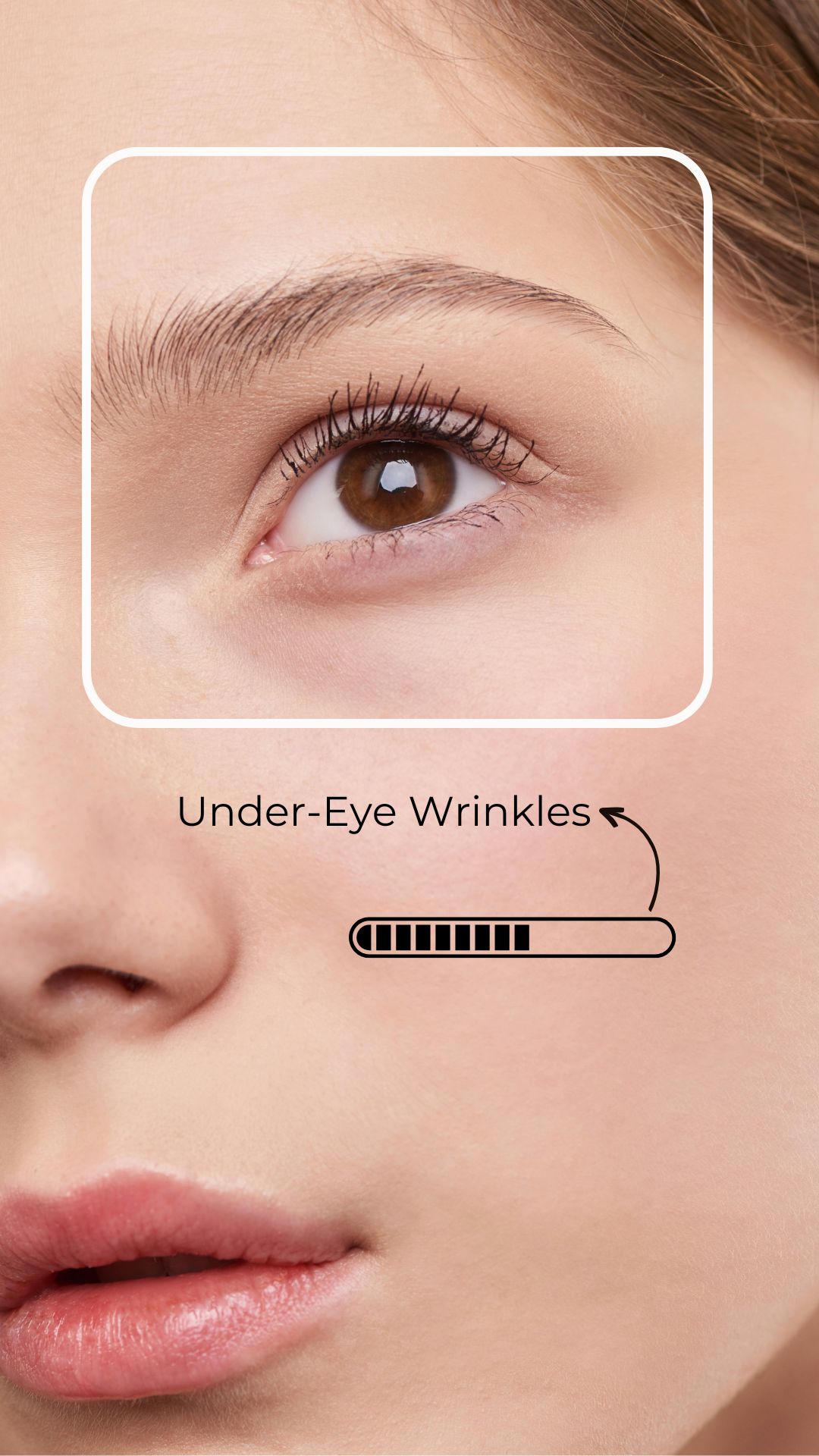 ANALYZES SKIN FEATURES - Feature 2