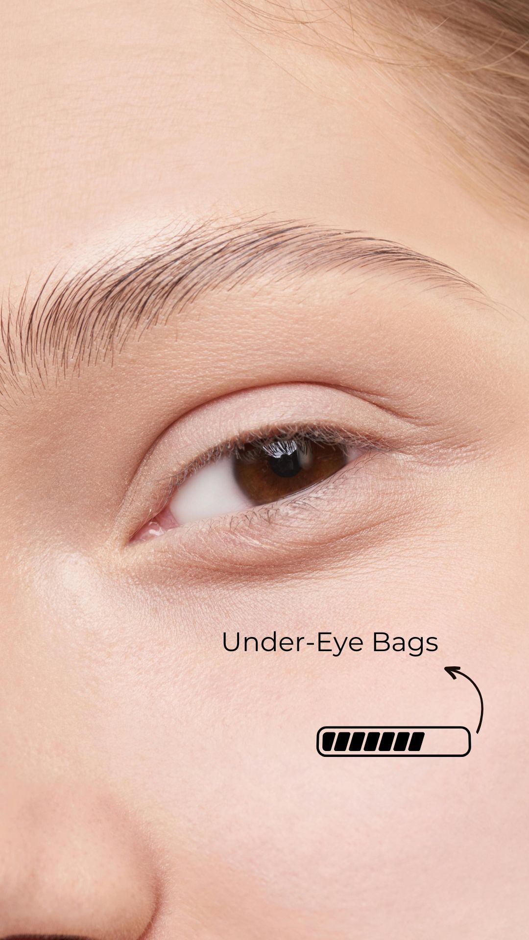 ANALYZES SKIN FEATURES - Feature 3