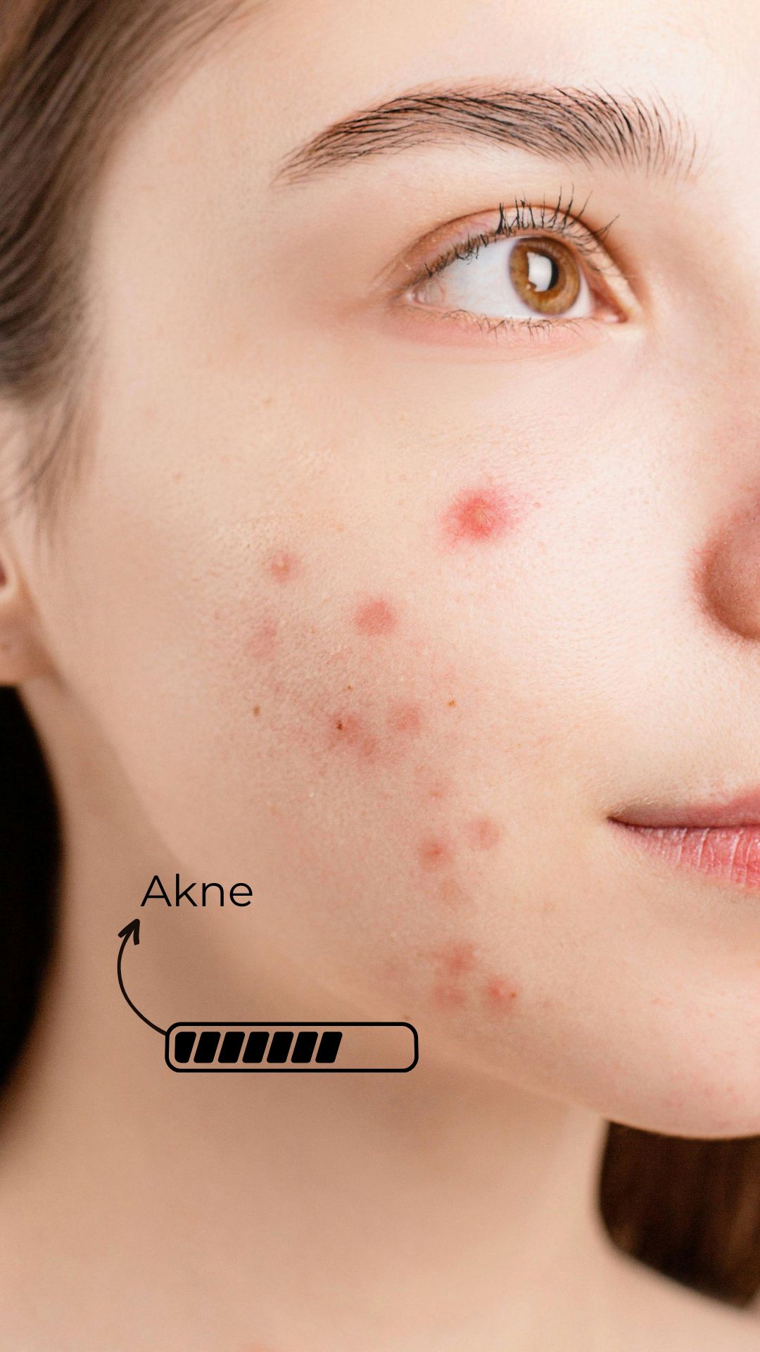 CİLT ÖZELLİĞİNİ ANALİZ EDER - Feature 5